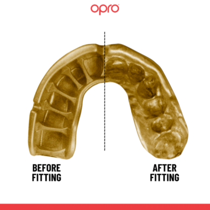 Gold Adult 10+ - Gold Grillz - Image 7